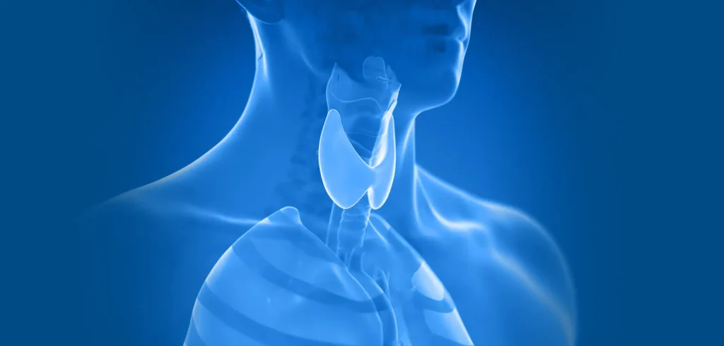 Thyroid ablation illustration