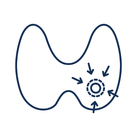 Shrink Icon