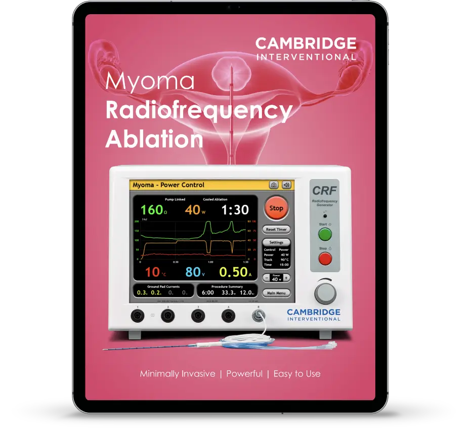 Myoma Radiofrequency Ablation
