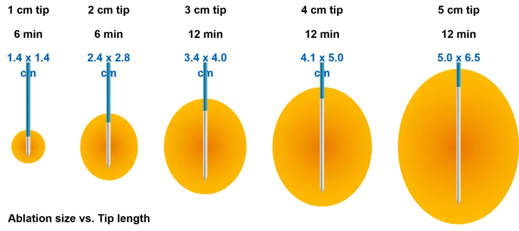 Ablation Size vs. Tip Length