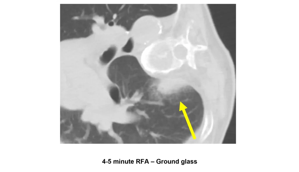 Ground Glass
